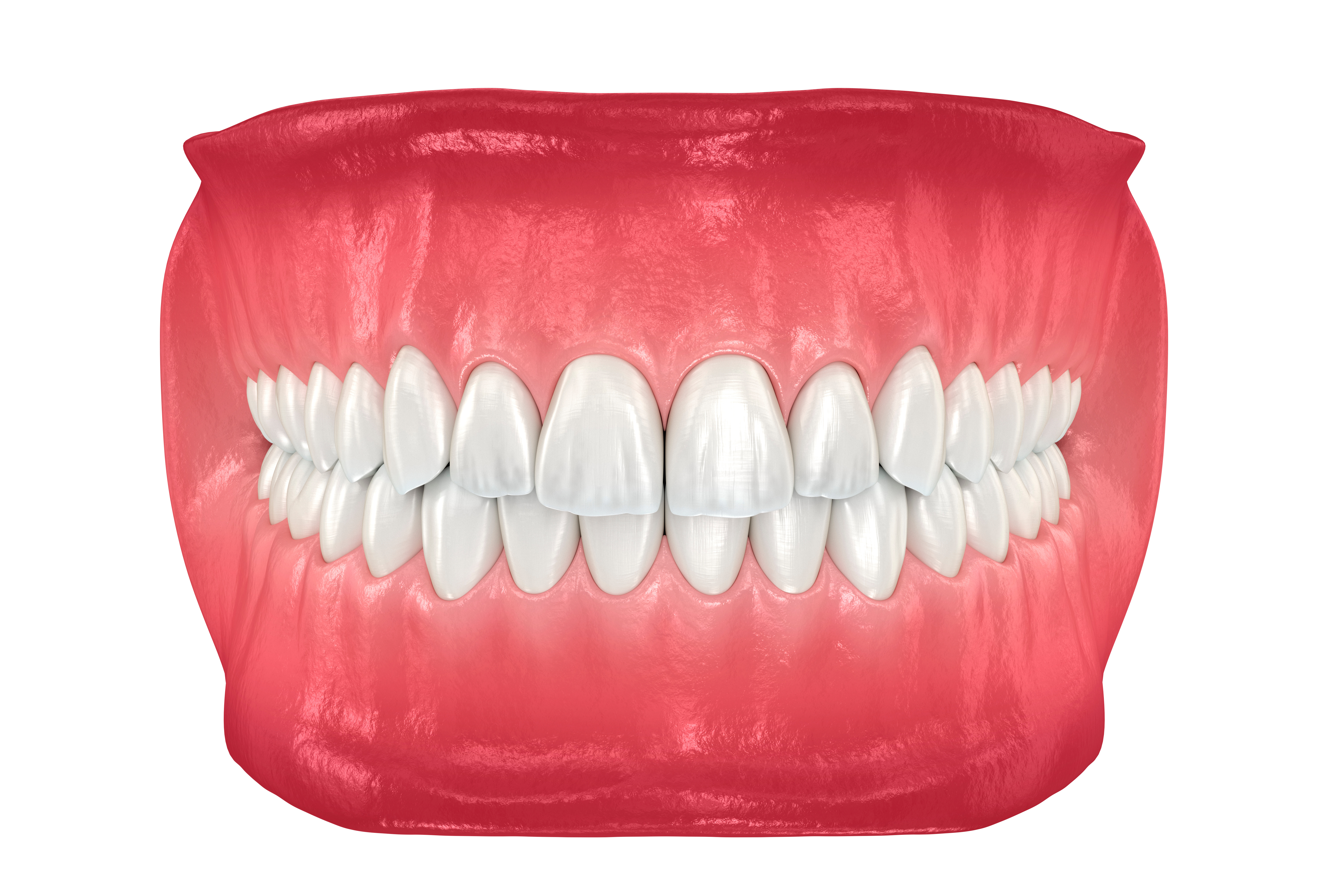 Healthy human teeth with normal occlusion. Medically accurate to
